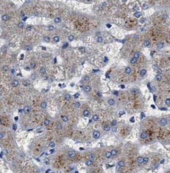 Catalase Specific Rabbit Polyclonal Antibody