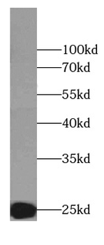 EIF4E Rabbit Polyclonal Antibody