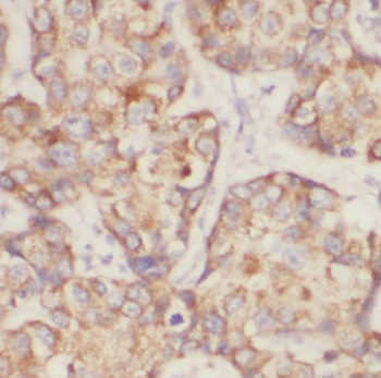EIF4E Rabbit Polyclonal Antibody
