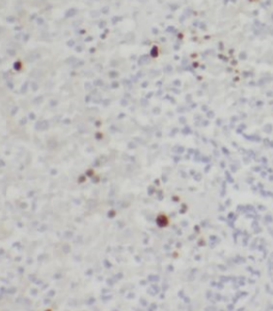 CD40LG Rabbit Polyclonal Antibody