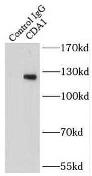 TSPYL2 Antibody