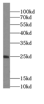 ITGB3BP Rabbit Polyclonal Antibody