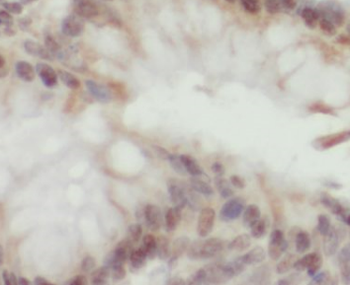 ITGB3BP Rabbit Polyclonal Antibody