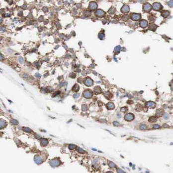 CEP350 Specific Rabbit Polyclonal Antibody