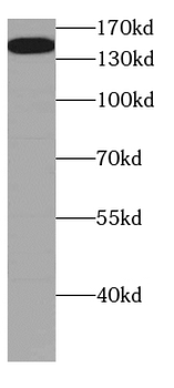 CGNL1 Antibody
