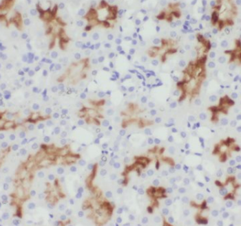 CHST13 Specific Rabbit Polyclonal Antibody