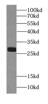 CTRL Rabbit Polyclonal Antibody