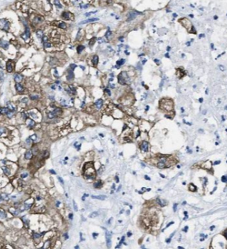 CTRL Rabbit Polyclonal Antibody