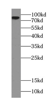 SH3KBP1 Antibody