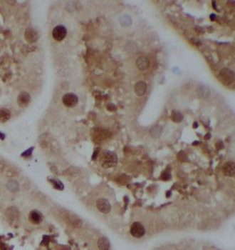 CISD2 Specific Mouse Monoclonal Antibody