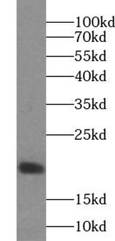 CLDN4 specific Rabbit Polyclonal Antibody
