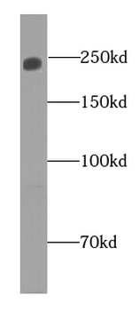 CLSPN Rabbit Polyclonal Antibody