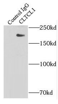 CLTCL1 Antibody