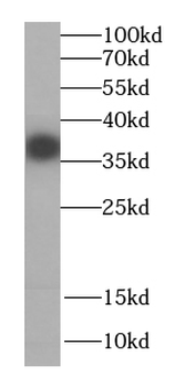 CPOX Antibody