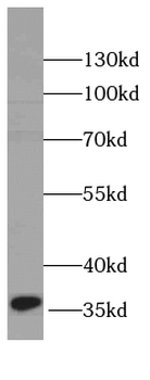 C1GALT1C1 Antibody