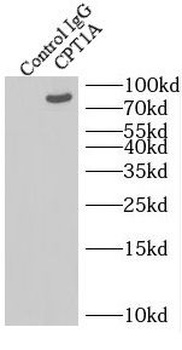 CPT1A Mouse Monoclonal Antibody