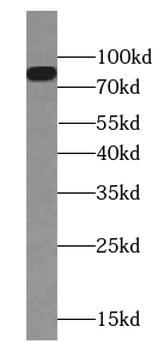 CPT1A Mouse Monoclonal Antibody