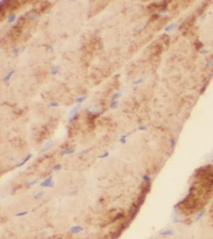 CPT1A Mouse Monoclonal Antibody