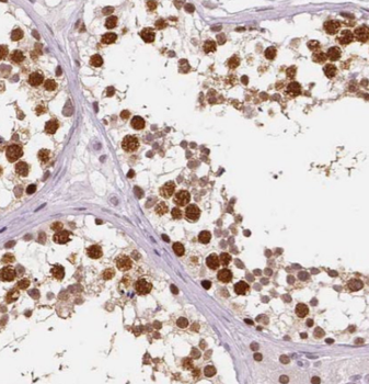 CPT1C Mouse Monoclonal Antibody