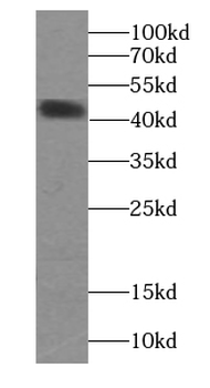 Creatine Kinase MM Antibody