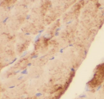 Creatine Kinase MM Specific Mouse Monoclonal Antibody
