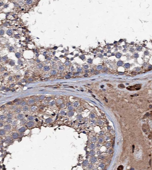 CSTL1 Antibody