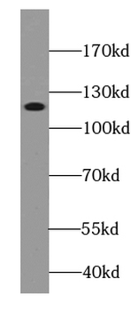 CTAGE1 Mouse Monoclonal Antibody