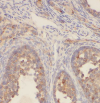 CTAGE1 Mouse Monoclonal Antibody