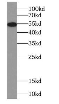 CYP2E1 Specific Rabbit Polyclonal Antibody