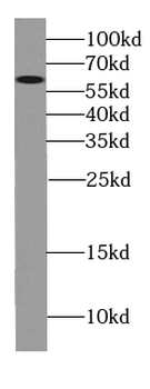CYP4F11 Specific Rabbit Polyclonal Antibody