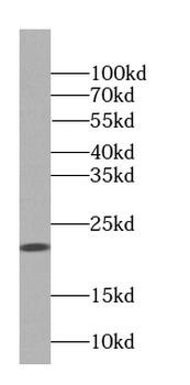 CDO1 Rabbit Polyclonal Antibody