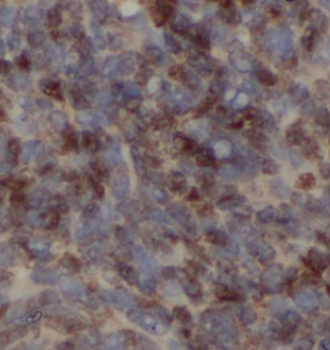 CDO1 Rabbit Polyclonal Antibody