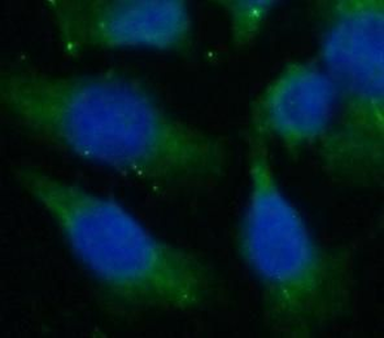 CYGB Mouse Monoclonal Antibody