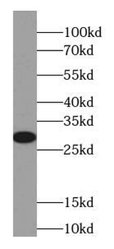 CYGB Mouse Monoclonal Antibody