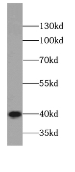 KRT19 specific Rabbit Polyclonal Antibody