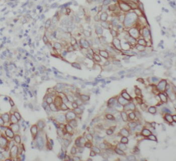 KRT19 specific Rabbit Polyclonal Antibody
