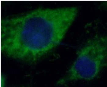 KRT1 specific Rabbit Polyclonal Antibody