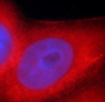 KRT7 Antibody