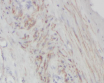 KRT7 specific Rabbit Polyclonal Antibody