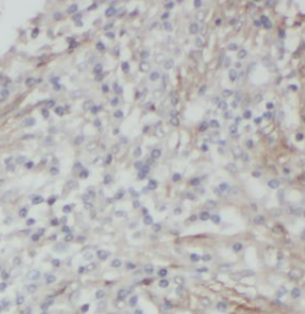 DSP Rabbit Polyclonal Antibody