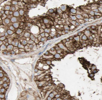 DNAH14 Antibody