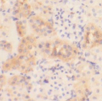 FIZ1 Rabbit Polyclonal Antibody