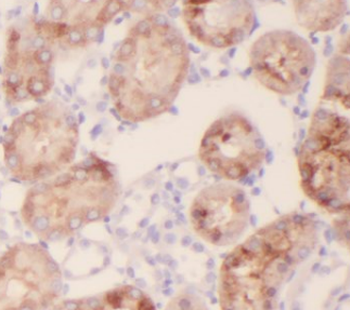 FIZ1 Rabbit Polyclonal Antibody