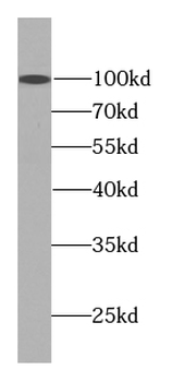 DSE Mouse Monoclonal Antibody