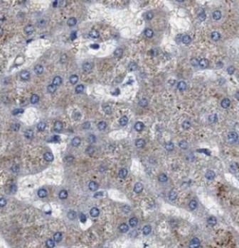 DSE Mouse Monoclonal Antibody
