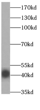 EAF1 Rabbit Polyclonal Antibody