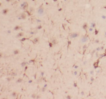 EAF1 Rabbit Polyclonal Antibody