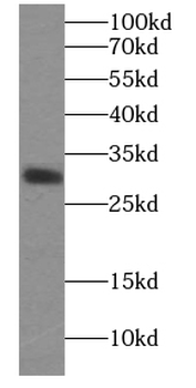 ECHS1 Mouse Monoclonal Antibody