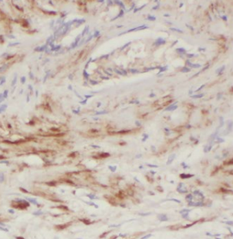 ECHS1 Mouse Monoclonal Antibody