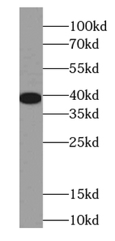 EEF1D Antibody